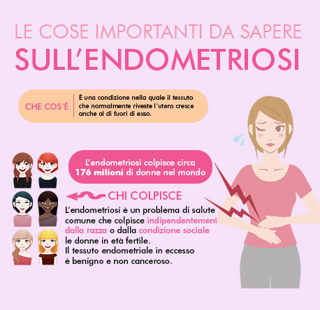 Infografica: le cose importanti da sapere sull'endometriosi